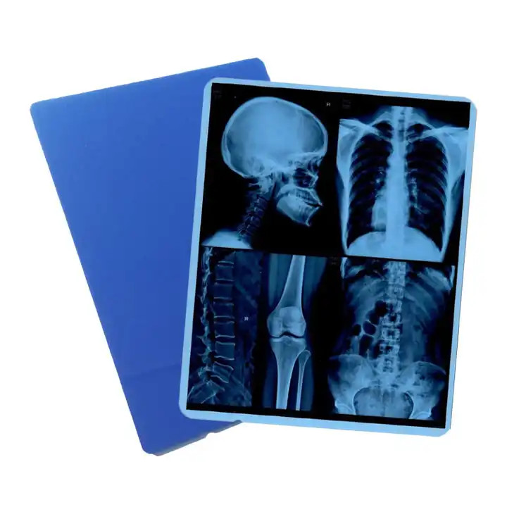 Professional High Image Stability Medical Film Inkjet For Accurate Diagnosis