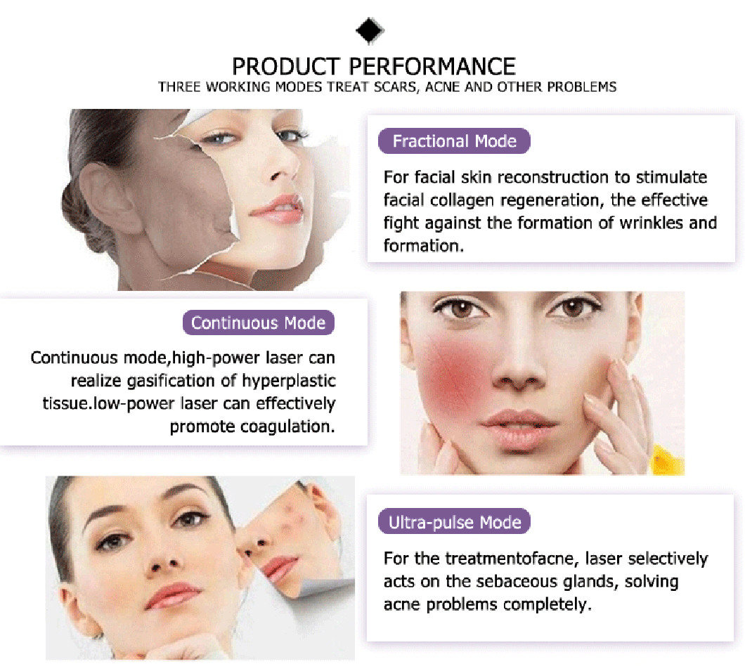 China factory direct sales carbon dioxide skin resurfacing fractional laser for stretch marks