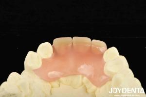 Quality Revolutionize Your Dental Practice with Lightweight and Diverse Products wholesale