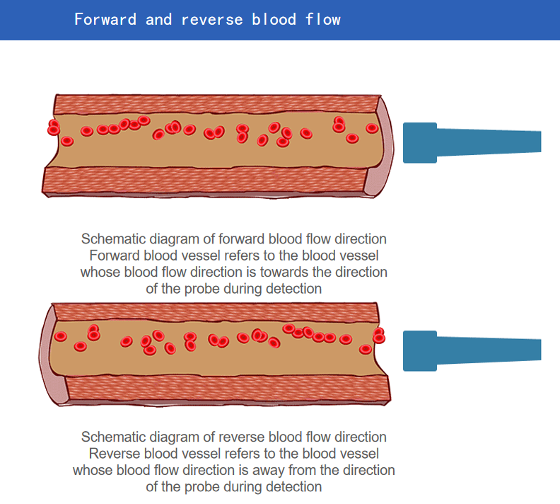 Four-depth Ultrasound Transcranial Doppler blood vessels analysis TCD system