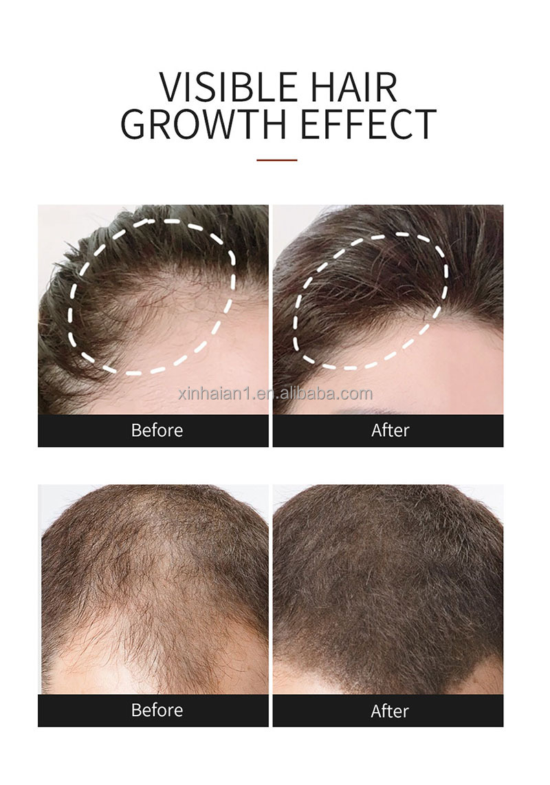 Customization Hair Growth Treatment Serum for Black Women Private Label