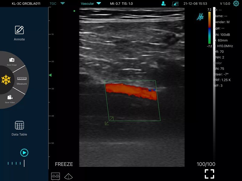 GH G10RL USB Portable Color Doppler Ultrasound Transducer Machine