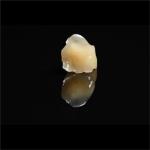 Metal Free Composite Crowns Inlays And Onlays Bridges Implants ODM