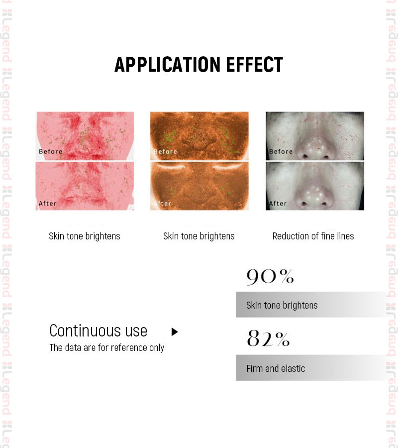 Newest Hot Sale Professional Skin Auto MD Electroporation Needle System Microneedling Derma Pen