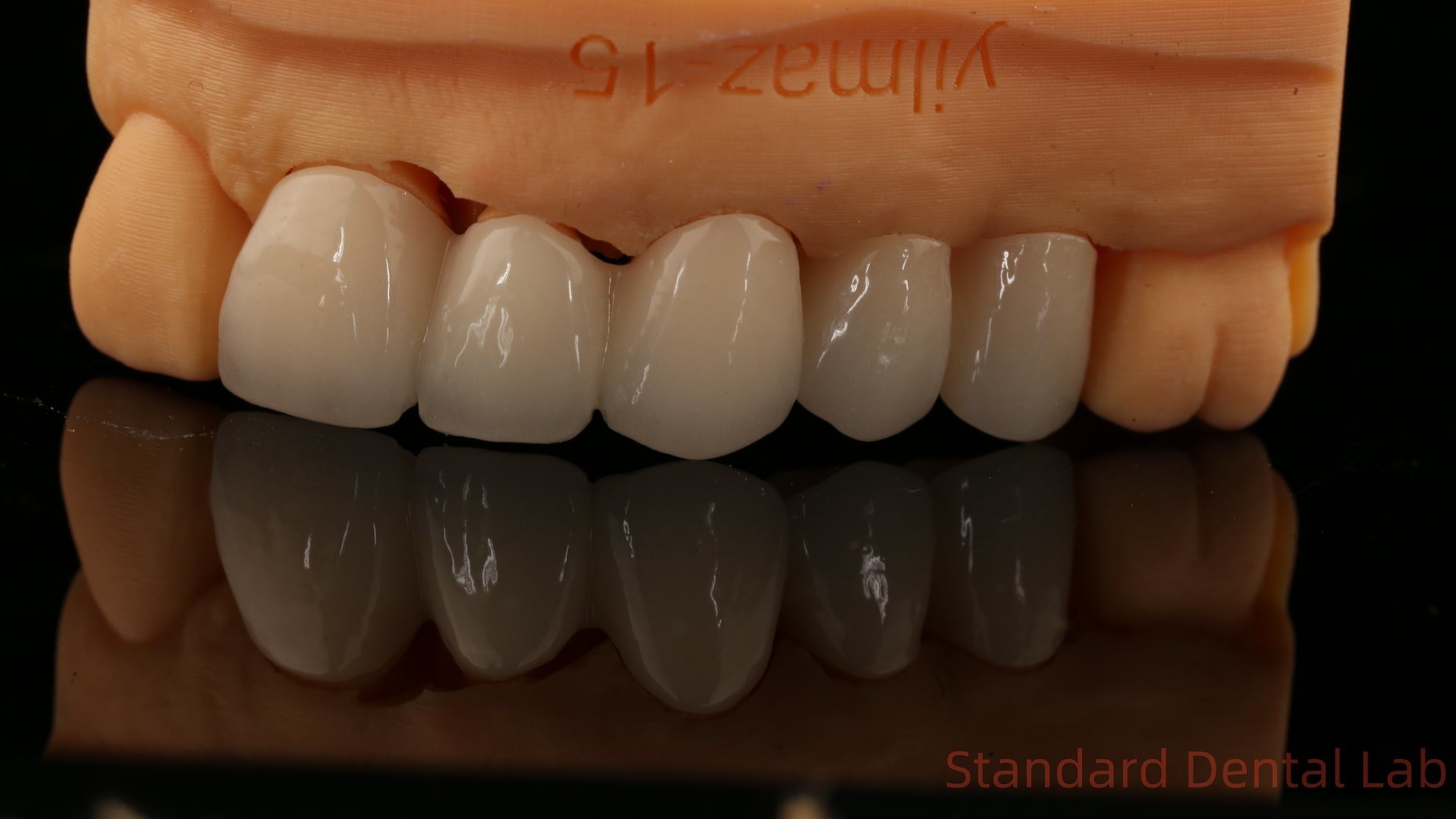 High Aesthetic Anterior Teeth Full Contour Zirconia Crown with Customized Vita Shade Dental Lab