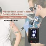 P3 Manufacturer Pico Laser Q Switch Laser Tattoo Removal Scar Machine