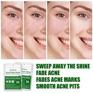 Quality Silicone Gel Invisible Pimple Patch Tea Tree Oil Ultra Thin Concealing Anti Acne Patch wholesale