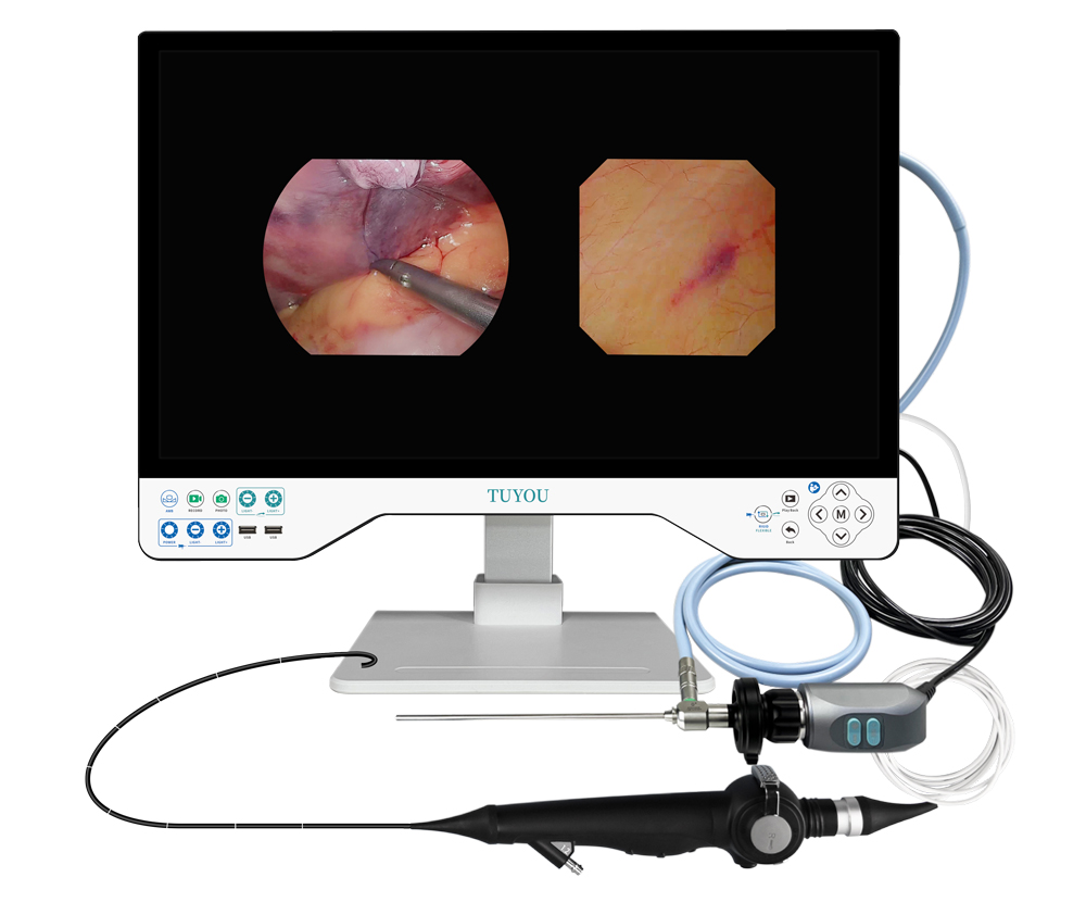 24in TUYOU Nasopharyngoscope Endoscope Camera Recorder For High Definition Laparoscopy Surgeries