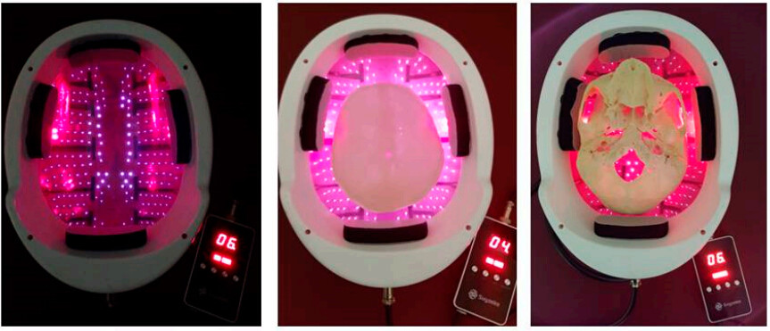 Professional LED Light Therapy Machine Brain Photobiomodulation Improve Blood Circulation
