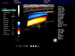 Hospital Diagnostic Machine Full Digital 4D Color Doppler Ultrasound Scanner