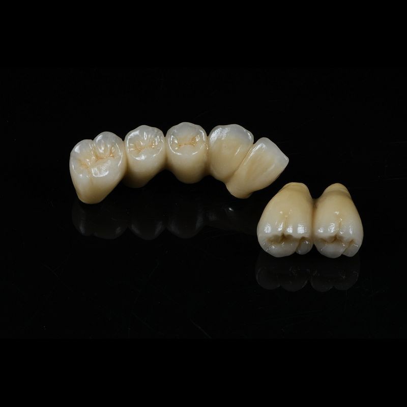 Cad Cam Implant PFM Crown Bridge Dental Medical Grade Adhesive