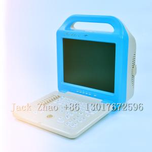 Quality Medbes Full Digital Ultrasound Scanner Machine Price wholesale