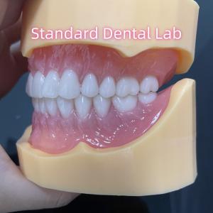 Quality Durable Dental Prosthesis Full Arch Acrylic Teeth Partial Removable Dentures wholesale