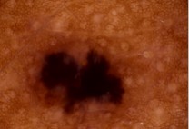 Wifi Skin Video Dermatoscope 2.5W For 3 Hours