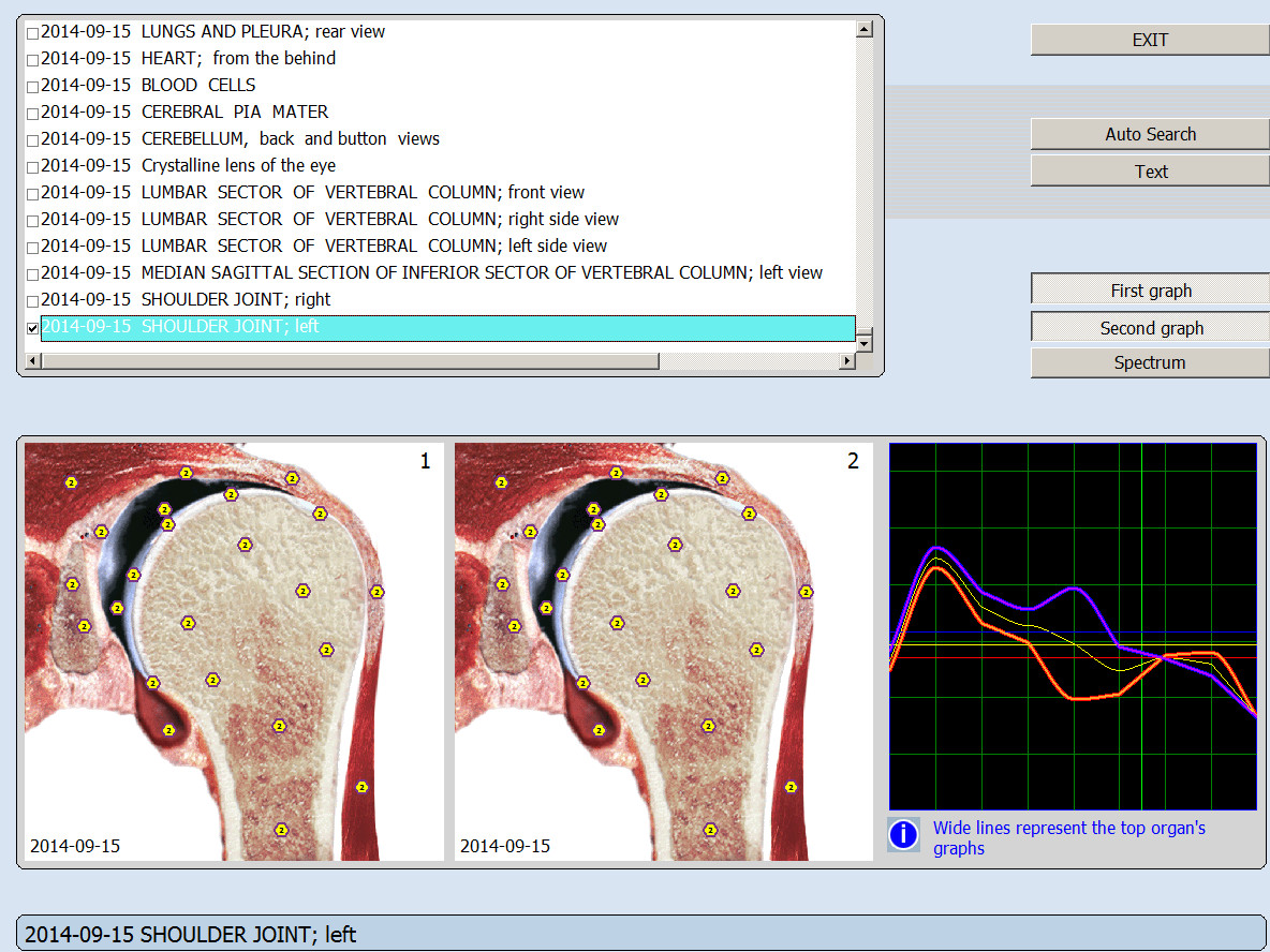 Professional Silver Portable 8D NLS IRIS Body Health Analyzer Machine Clinical Version