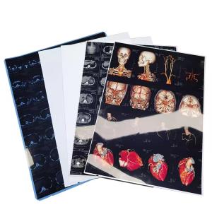 Quality Canon/Epson Inkjet Printers Compatible Medical X ray films 9600x2400dpi High Resolution wholesale