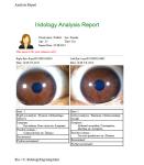 Green Iris Recognition Camera Iridology Device English Spanish Chinese