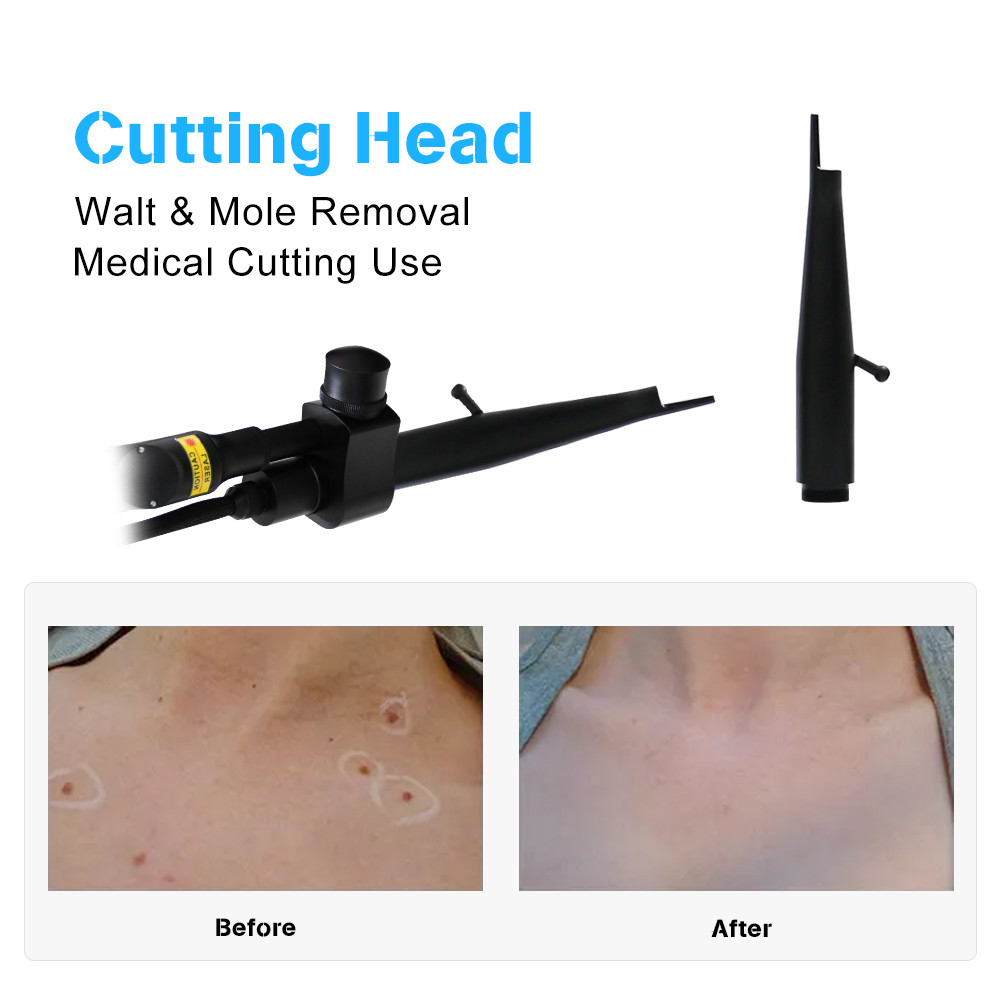 ZGV13-03 2024 Powerful Ultra 10600nm Co2 Fractional Laser Wrinkle Remover Skin Resurfacing Machine