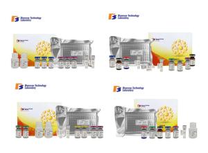 Quality NMDAR1 Human Sandwich Immunosorbent Assay Kit With Strong Sensitivity wholesale