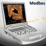 Full Digital Portable doppler Ultrasound Scanner