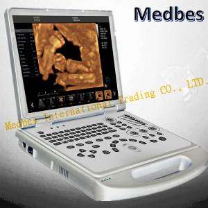 Quality Full Digital Portable doppler Ultrasound Scanner wholesale