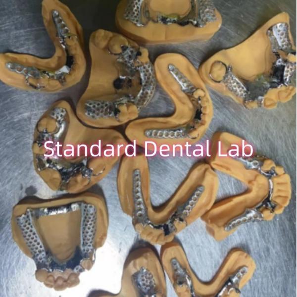 Cheap Removable Cobalt Chrome Cast Metal Framework Partial Dentures for sale