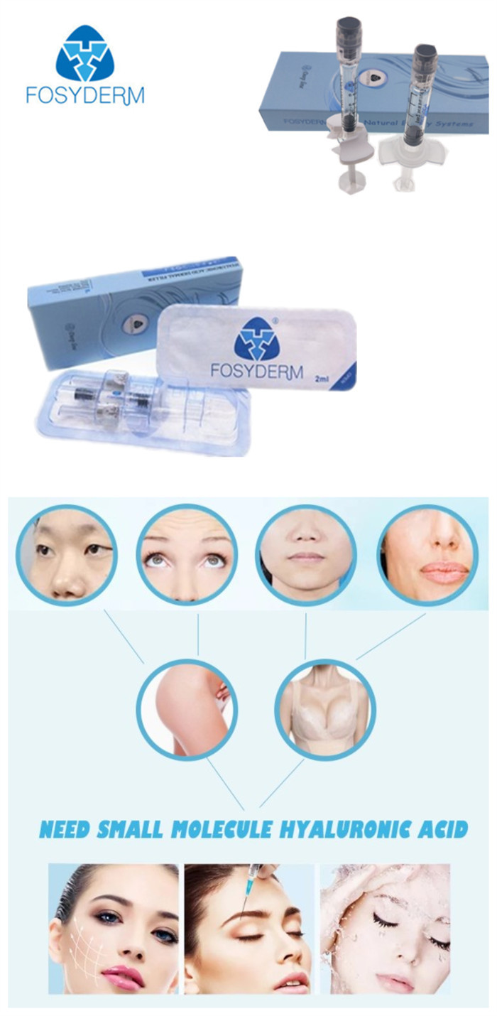 Cross Linked Sodium Hyaluronate Injectable Dermal Filler