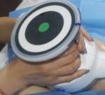 Ultrashape HIFU body care slim system new generation new technology beauty
