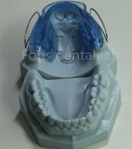 Quality China Dental Lab Orthodontic Retainer Expander Adjustable And Customizable wholesale