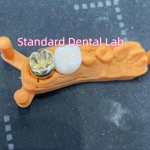 Quality Non Precious Yellow Metal Alloy Crown Full Cast With Zirconia Crown wholesale