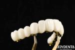 Custom-made Zirconia Excellent Strength for Individualized Dental Solutions