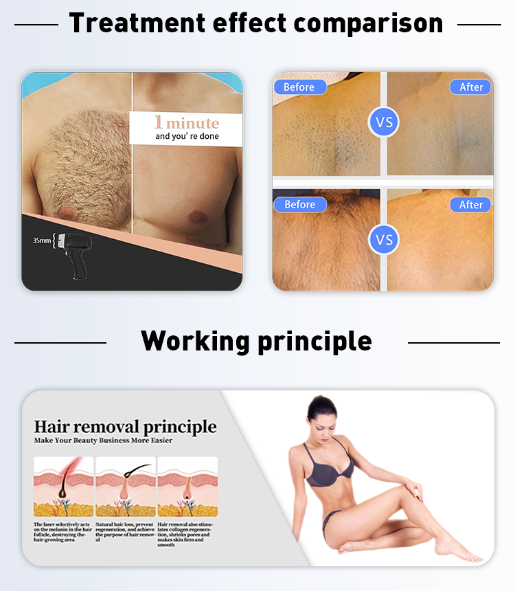 1200W 1600W Portable Diode Laser Hair Removal Skin Rejuvenation for Commercial Buyers