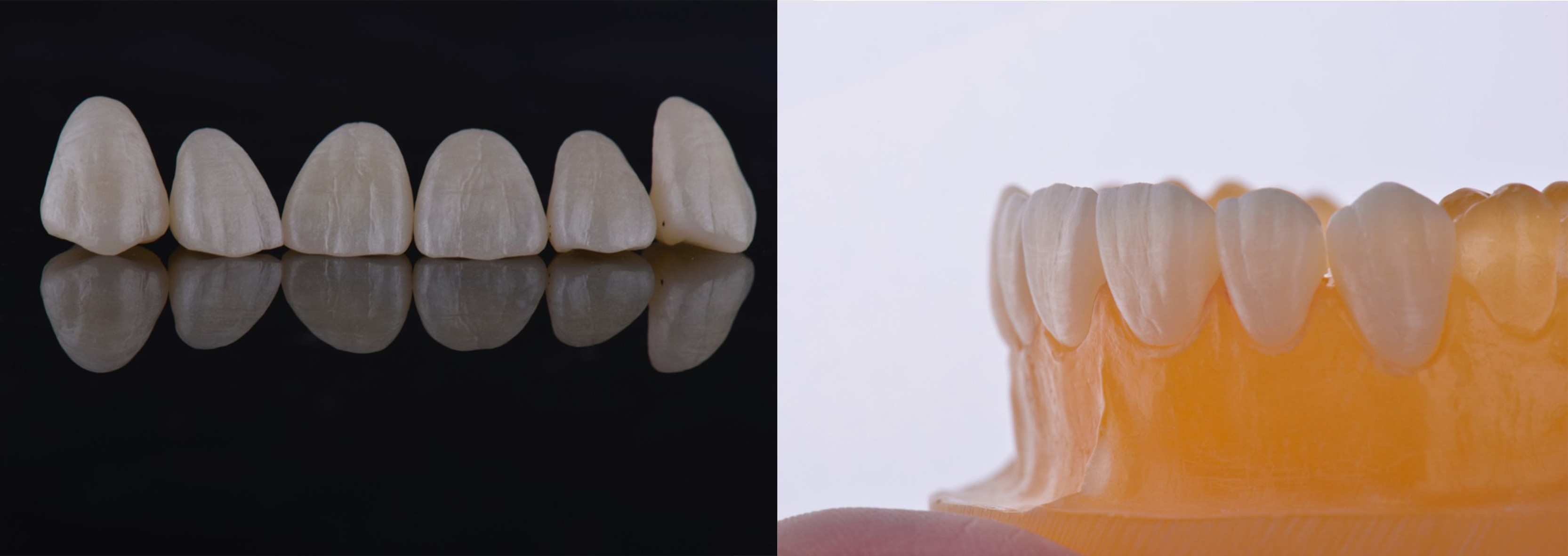 YUCERA ST 45% Translucent Pre Shaded Zirconia Blocks