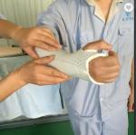 Low Temperature Thermoplastic Orthosis Fracture Splint Orthopedic Immobilization