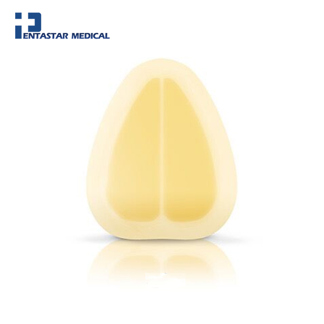 CE approved sterile bacteria wound care hydrocolloid bordered dressing for 1st and 2nd degree burn