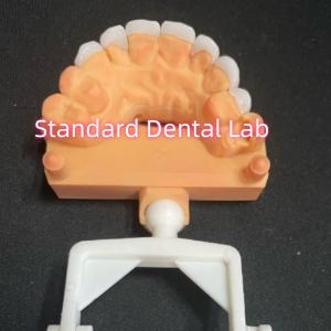 Quality Natural Looking Laminate Zirconia Emax Veneers Thikness 0.6mm wholesale
