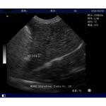 Hospital Digital Trolley color doppler ultrasound Transvaginal Ultrasound