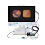 Good Quality 1080P 15.6 Inch Medical Endoscopy Equipment Rigid & Flexible