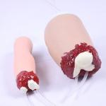Upper Limb Amputated Trauma Hemostasis Medical Training Model For Surgical