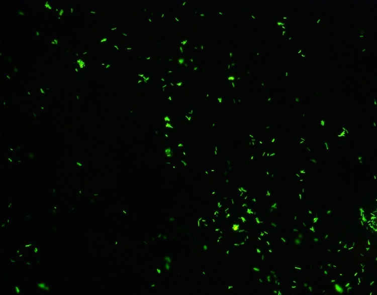 Acid Fast Stain Reagents Phenol Free Auramine O Staining Method For Auto Stainer
