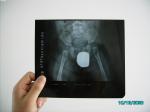 Low Fog Medical Imaging Film Dry X-ray For AGFA / Fuji / Kodak Printer