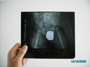 Quality Silver Halide Laser X Ray Medical Imaging Waterproof Thin Agfa DRYSTAR DT1B / DT2B wholesale