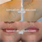 Women Facial IPL Hair Removal Machines , Full Body Laser Hair Removal Equipment