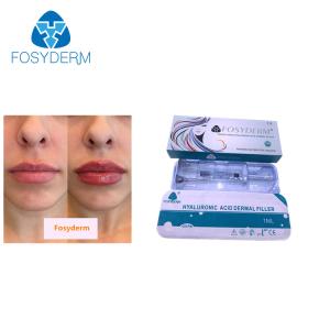 Quality 1ml Hyaluronic Acid Injection Fosyderm Dermal Filler for Lip wholesale