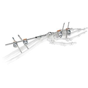 Quality Medical Orthopedic Surgical Implant Joint Wrist External Fixator wholesale