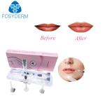 2ml Dermal Cross Linked Hyaluronic Pen Fillers