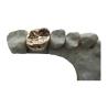 Buy cheap Full Metal PFM Dental Crown Bridge High Tech Biological Material from wholesalers