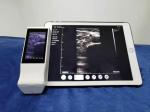 Portable wireless 7.5mhz linear doppler ultrasound probe