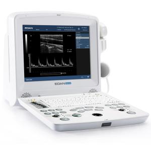 Quality Best Price Edan DUS 60 B/W PW black and white ultrasound machine wholesale