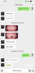Customizable Dental Maryland Resin Bonded Bridges for Anterior And Premolar
